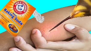 14 EFFECTIVE Home Remedies For Bee Stings  Natural Bee Sting Treatment [upl. by Lyda]