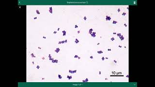 staphylococcus aureus  المكورات العنقودية الذهبية [upl. by Concoff877]