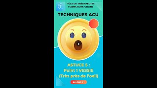 TECHNIQUES DACUPUNCTURE  Point 1 VESSIE  Technique souscutanée astuces [upl. by Otipaga]