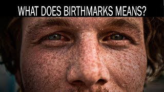 What does birthmarks means [upl. by Vergil707]