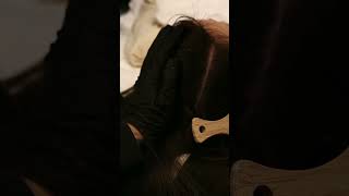 What to do if your scalp is inflamed See how this [upl. by Gerlac]