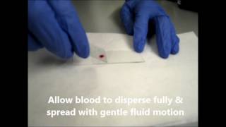 Blood Smear Preparation [upl. by Sidonnie]