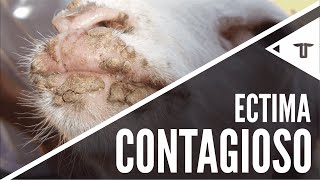 Ectima Contagioso [upl. by Estis]