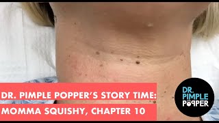 Dr Pimple Poppers Weekly Story Time Momma Squishy Chapter 10 [upl. by Adrien590]