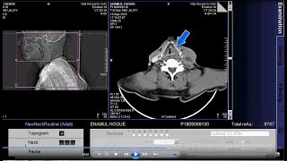 How Do We Sing  The Anatomy Of A Singer Webinar [upl. by Yllehs]