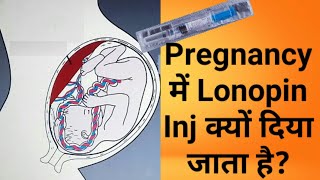 Lonopin injection in pregnancy [upl. by Dutch]