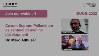 ISUOG 2022 Webinar  Cavum Septum Pellucidum as sentinel of midline development Dr Marc Althuser [upl. by Lunetta412]