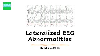 Lateralized EEG Abnormalities [upl. by Ludwig752]