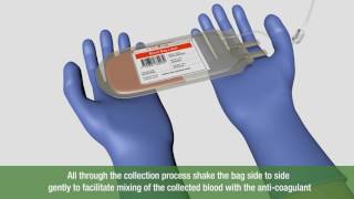 Cord Blood Banking Process Explained  Must Watch [upl. by Ahsilat751]