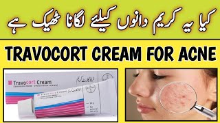 Travocort Cream Used For Acne  Travocort Cream [upl. by Siraval97]