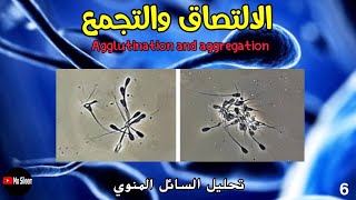 التجمع والالتصاق agglutination and aggregation [upl. by Aubry]