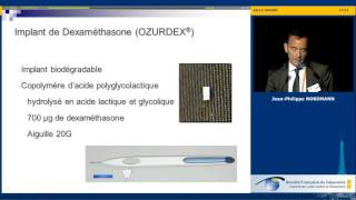 Quel est le risque d’hypertonie avec les IVT d’antiVEGF JeanPhilippe Nordmann [upl. by Sewell]