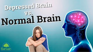 Depressed Brain vs Normal Brain [upl. by Romelda]