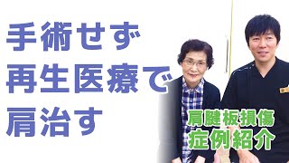 【肩腱板損傷の再生医療】腕が90度以上上がらない！実際の患者さんの回復した症例を交えて手術をしない治療法を医師が徹底解説！ [upl. by Kettie]