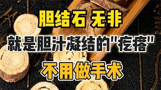 胆结石，无非就是胆汁凝结的‘疙瘩’，不用做手术 [upl. by Kotta]