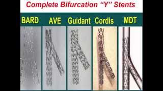 Bifurcation Lesions [upl. by Steinman]