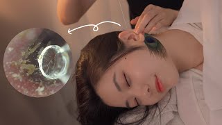 ASMR 보면서 받는 귀청소👂  내시경 구름칼 공작털 솜털  Visual Ear Cleaning asmr [upl. by Heisser]