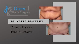 Tummy Tuck vs Panniculectomy  Greer Plastic Surgery  Cleveland OH [upl. by Gruber269]