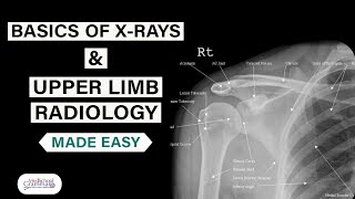 Radiological Anatomy Made Easy Basics of XRays and Upper Limb Radiology [upl. by Wait724]