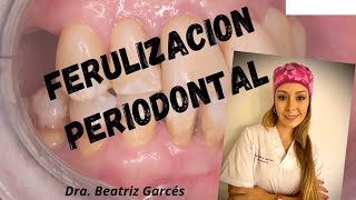 FERULIZACION PERIODONTAL en paciente con TRAUMA OCLUSAL [upl. by Merralee849]