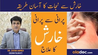 Kharish Khatam Karne Ka Tarika  Scabies Ka Ilaj In Urdu  Itching Treatment  Kharish Ka Fori Ilaj [upl. by Ahens]