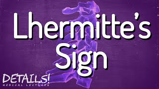 Lhermittes Sign  Multiple Sclerosis  Details [upl. by Ingrid]