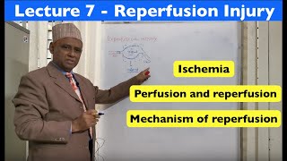 General Pathology  Lecture 7  Reperfusion Injury [upl. by Oniliuqnart]