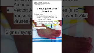 Chikungunya virus infection [upl. by Inttirb]