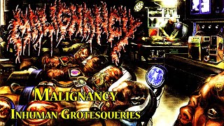 Malignancy  Inhuman Grotesqueries [upl. by Hollinger]