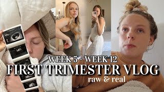 RAW amp REAL FIRST TRIMESTER VLOG weeks 512 morning sickness remedies tips processing pregnancy [upl. by Colon258]