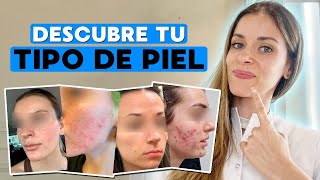 CÓMO SABER MI TIPO DE PIEL  Dermatóloga te explica los tipos de pieles [upl. by Iden115]