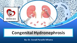 Congenital Hydronephrosis [upl. by Montanez]