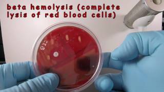 Streptococcus pyogenes on Blood Agar with a Taxo A Disc [upl. by Pierpont86]