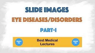 Eye diseases and disorders  Symptoms and treatments  Image based discussion Part1 [upl. by Agbogla921]