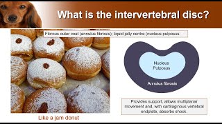 Types of Intervertebral disc disease  from the expert [upl. by Sirrap970]