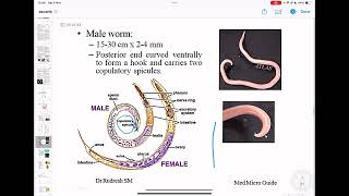 Ascaris Lumbricoides  Panikers  Apurba S Sastry [upl. by Brittani]