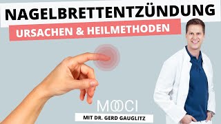 Was tun bei Nagelbettentzündung  10 Fragen an PD Dr med Gerd Gauglitz  MOOCI [upl. by Vanya]