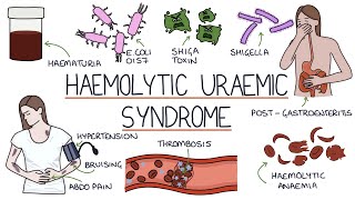 Haemolytic Uraemic Syndrome [upl. by Claudie]