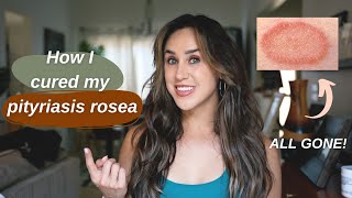 How I Cured My Pityriasis Rosea [upl. by Thistle]