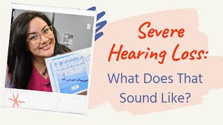 Hearing Speech With A Severe Hearing Loss  Severe Hearing Loss Simulation [upl. by Enilemme225]