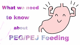 What we need to know about PEGPEJ feeding [upl. by Sonitnatsok303]