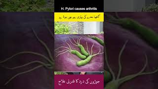 WARNING H Pylori Infection Could Be CAUSING Your Arthritis arthritis hpylori guthealth [upl. by Melisandra813]