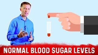 What is Normal Fasting Blood Sugar Levels on Intermittent Fasting – DrBerg [upl. by Danie636]