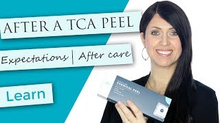 After TCA Peel  What to Expect  Flaking  Discoloration  Healing  FAQs [upl. by Moishe]