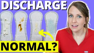 Doctor Answers Top 5 Discharge Questions [upl. by Leahcimnhoj]