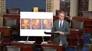 Sen Lankford Delivers Powerful ProLife Floor Speech FULL [upl. by Akemeuwkuhc386]