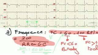 ECG de A à Z  ECG normal Rythme et Frequence [upl. by Bridges]