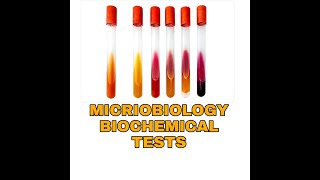 Biochemical Tests for Bacterial IdentificationTSIUrease Citratemicrobiology Biochemical tests [upl. by Tedmann]