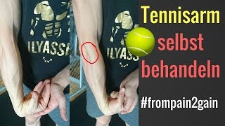 Tennisarm  Tennisellenbogen selbst behandeln  3 Methoden die funktionieren│Mischa Kotlyar [upl. by Pish]