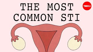 The most common STI in the world  Emma Bryce [upl. by Deedee94]